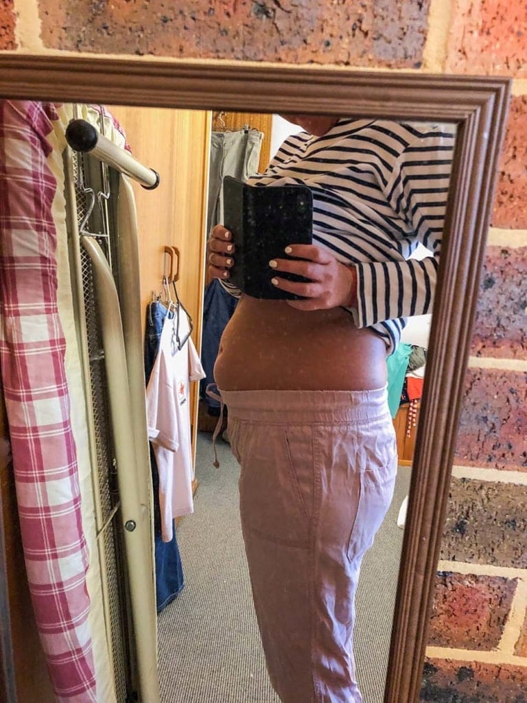 swollen-stomach-in-australia