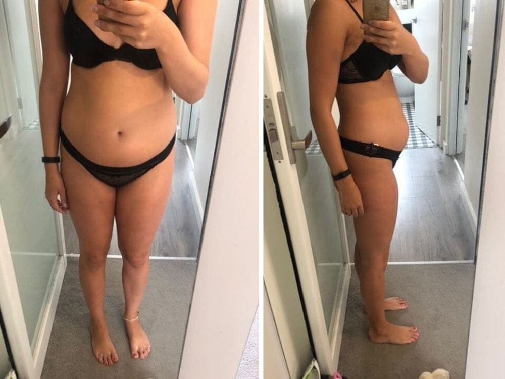 SIBO-gut-health-australia - Londoner In Sydney SIBO-gut-health-australia