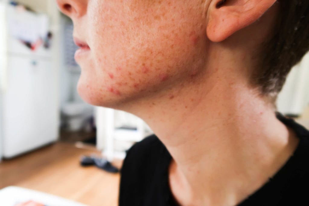 elemental-diet-day-4-1024x683-1